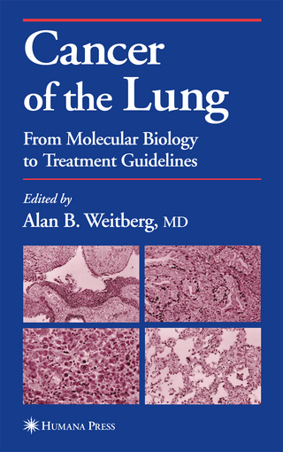 Cancer of the Lung - Alan Weitberg