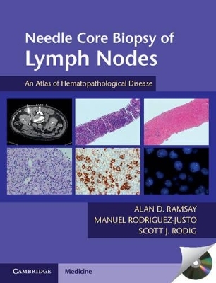 Needle Core Biopsy of Lymph Nodes with DVD-ROM - Alan D. Ramsay, Manuel Rodriguez-Justo, Scott J. Rodig