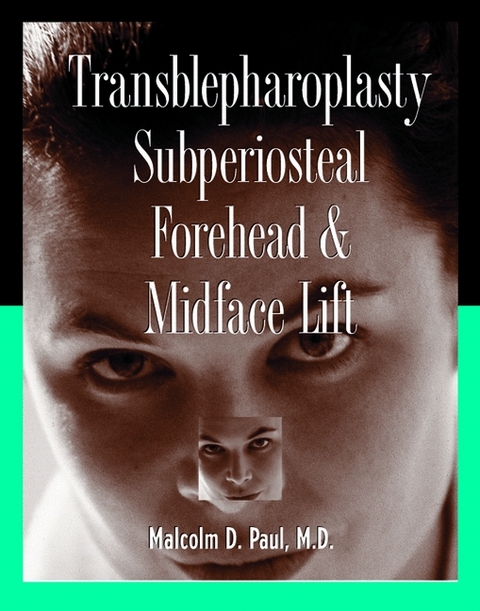 Transblepharoplasty Subperiosteal Forehead and Midface Lift - Malcolm D. Paul
