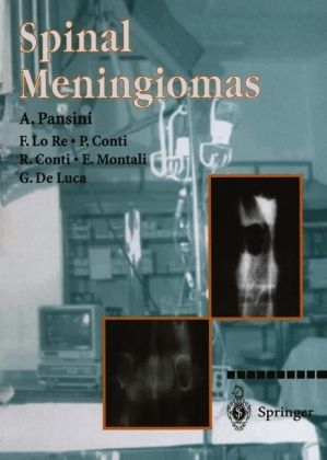 Spinal Meningiomas -  P. Conti,  G- De Luca,  E. Montali,  A. Pansini,  F. Lo Re