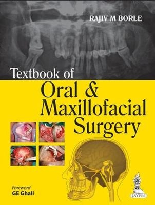 Textbook of Oral and Maxillofacial Surgery - Rajiv M Borle