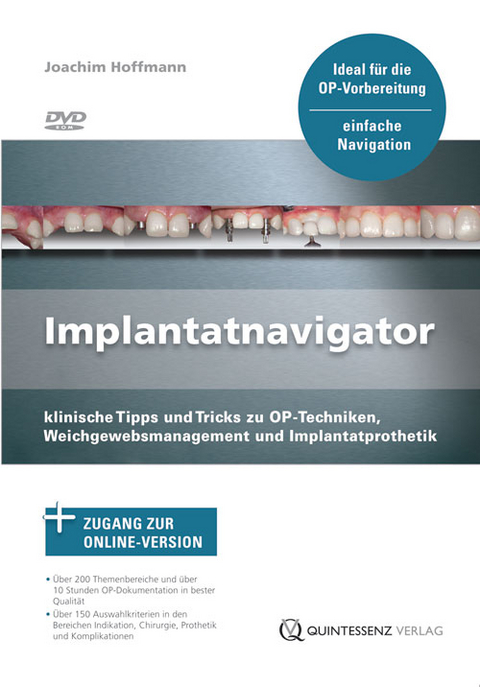 Implantatnavigator - Joachim Hoffmann