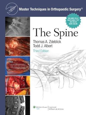 Master Techniques in Orthopaedic Surgery: The Spine - Thomas A. Zdeblick, Todd Albert