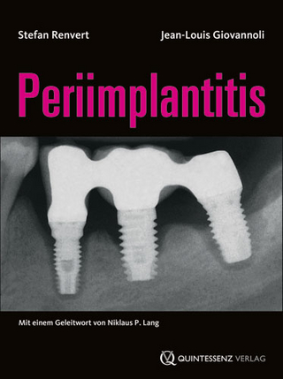 Periimplantitis - Stefan Renvert; Jean-Louis Giovannoli