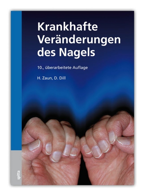 Krankhafte Veränderungen des Nagels - Hansotto Zaun, Dorothee Dill