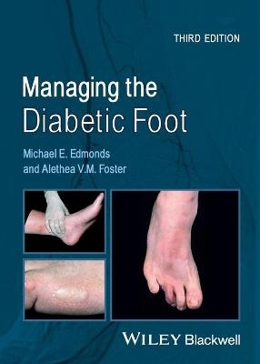 Managing the Diabetic Foot - Michael E. Edmonds, Alethea V. M. Foster