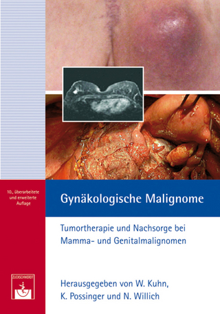 Gynäkologische Malignome - Walther Kuhn; Kurt Possinger; Normann Willich