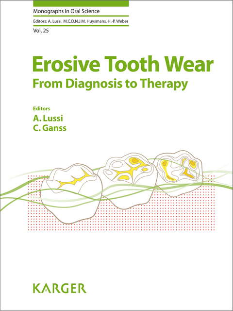 Erosive Tooth Wear - 