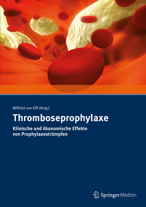 Thromboseprophylaxe Klinische und ökonomische Effekte von Prophylaxestrümpfen - Wilfried von Eiff
