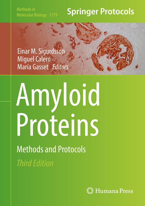 Amyloid Proteins - 