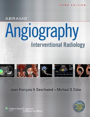 Abrams' Angiography - Jeffrey Geschwind; Michael Dake