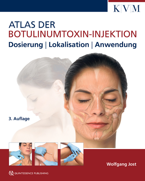 Atlas der Botulinumtoxin-Injektion - Wolfgang Jost