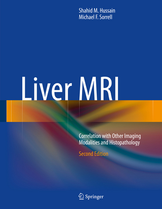 Liver MRI - Shahid M. Hussain; Michael F. Sorrell