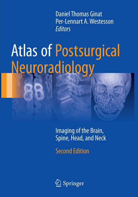 Atlas of Postsurgical Neuroradiology - 