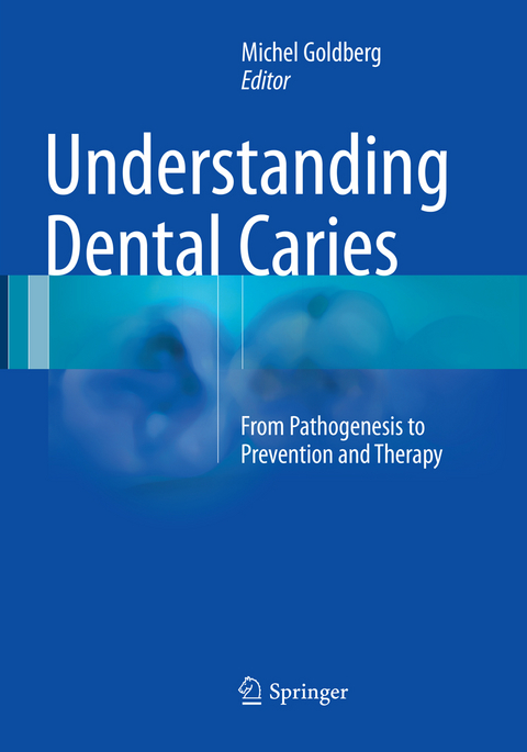 Understanding Dental Caries - 