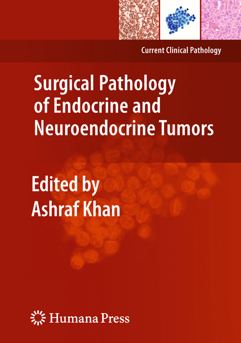 Surgical Pathology of Endocrine and Neuroendocrine Tumors - 