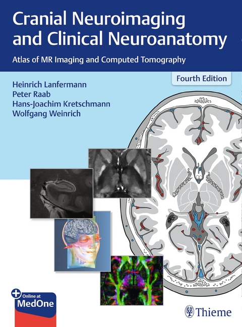 Cranial Neuroimaging and Clinical Neuroanatomy - 
