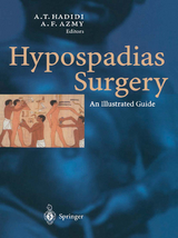 Hypospadias Surgery - 