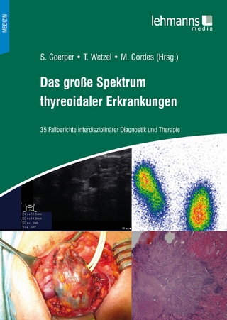 Das große Spektrum thyreoidaler Erkrankungen - Stephan Coerper; Wetzel Tobias; M. Cordes