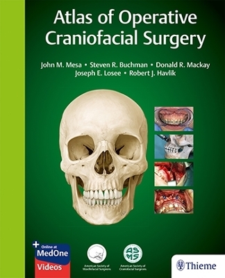 Atlas of Operative Craniofacial Surgery - 