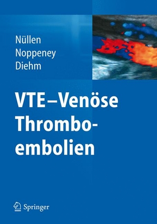 VTE - Venöse Thromboembolien - Helmut Nüllen; Thomas Noppeney; Curt Diehm