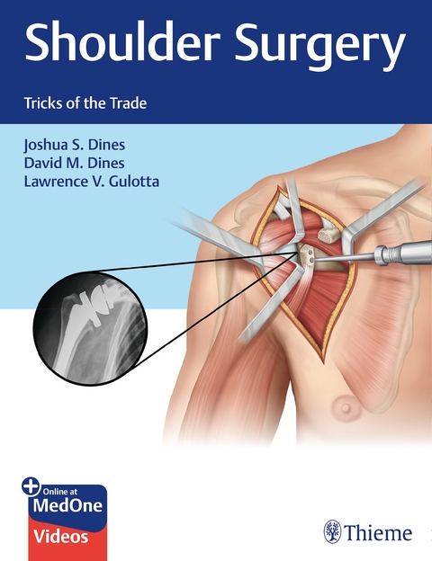 Shoulder Surgery - Joshua Dines, David Dines, Lawrence Gulotta