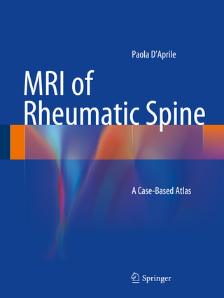 MRI of Rheumatic Spine - Paola D?Aprile