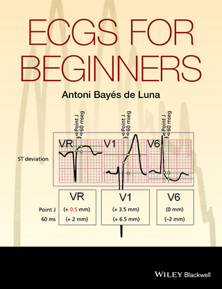 ECGs for Beginners - Antoni Bayés de Luna