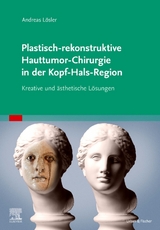 Plastisch-rekonstruktive Hauttumor-Chirurgie in der Kopf-Hals-Region - Andreas Lösler