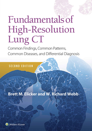 Fundamentals of High-Resolution Lung CT - Brett M Elicker; W. Richard Webb