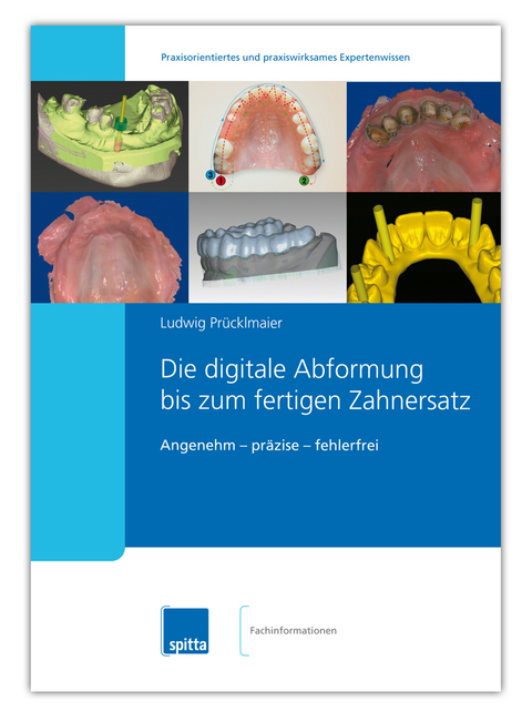 Die digitale Abformung bis zum fertigen Zahnersatz - Ludwig Prücklmaier