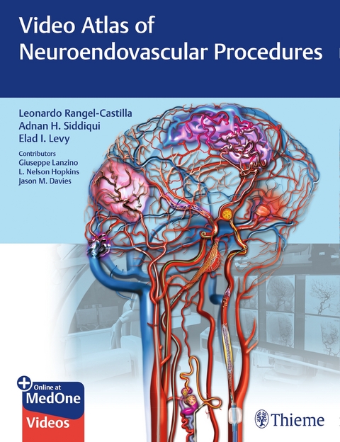 Video Atlas of Neuroendovascular Procedures - Leonardo Rangel-Castilla, Adnan Siddiqui, Elad Levy, Giuseppe Lanzino, Jason Davies