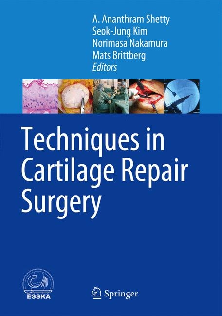 Techniques in Cartilage Repair Surgery - 