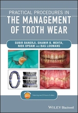 Practical Procedures in the Management of Tooth Wear - Subir Banerji