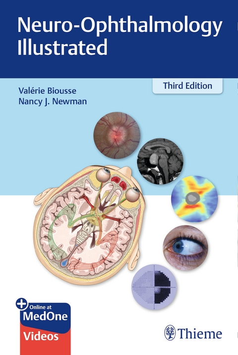 Neuro-Ophthalmology Illustrated - Valerie Biousse, Nancy Newman