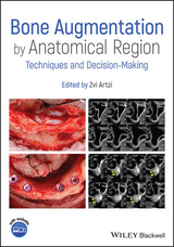 Bone Augmentation by Anatomical Region - 