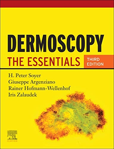 Dermoscopy - H. Peter Soyer, Giuseppe Argenziano, Rainer Hofmann-Wellenhof, Iris Zalaudek