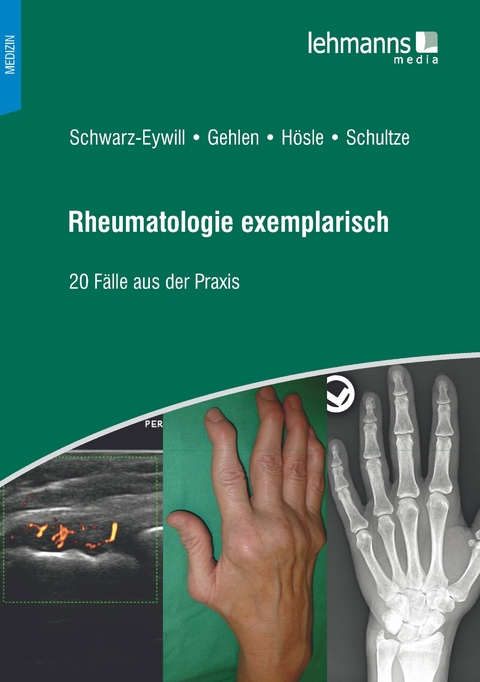 Rheumatologie exemplarisch - Michael Schwarz-Eywill, Martin Gehlen, Rosmarie Hösle, Mareen Schultze