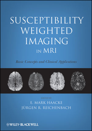 Susceptibility Weighted Imaging in MRI : Basic Concepts and Clinical Applications - 