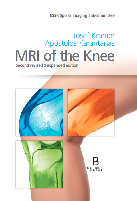 MRI of the Knee - 