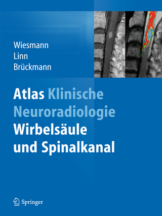 Atlas Klinische Neuroradiologie - Martin Wiesmann; Jennifer Linn; Hartmut Brückmann