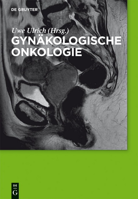 Gynäkologische Onkologie - 