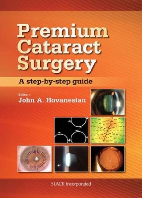 Premium Cataract Surgery - John Hovanesian