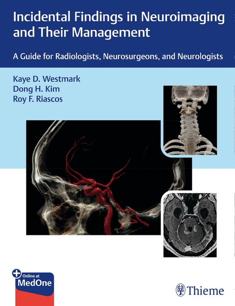 Incidental Findings in Neuroimaging and Their Management - Kaye Westmark, Dong Kim, Roy Riascos