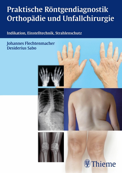Praktische Röntgendiagnostik Orthopädie und Unfallchirurgie -  Gabriele Angenendt,  Ursula Schütze-Kreilkamp,  Volker Tschuschke