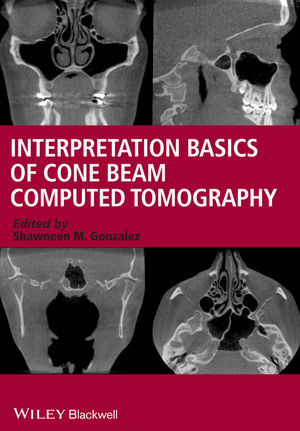 Interpretation Basics of Cone Beam Computed Tomography -  Shawneen M. Gonzalez
