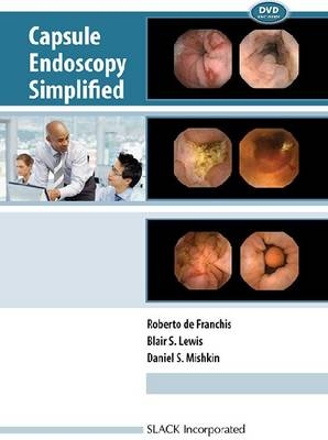Capsule Endoscopy Simplified - Blair Lewis; Daniel Mishkin; Roberto DeFranchis