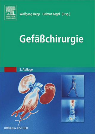 Gefäßchirurgie - Wolfgang Hepp; Helmut Kogel