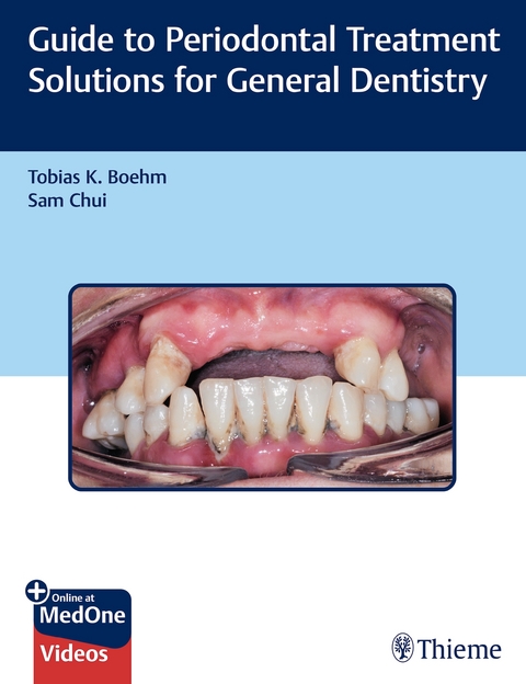 Guide to Periodontal Treatment Solutions for General Dentistry - Tobias Boehm, Sam Chui