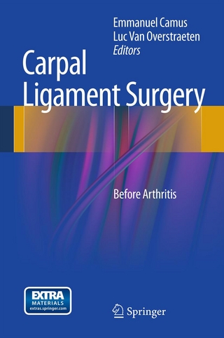 Carpal Ligament Surgery - Emmanuel Camus; Luc Van Overstraeten